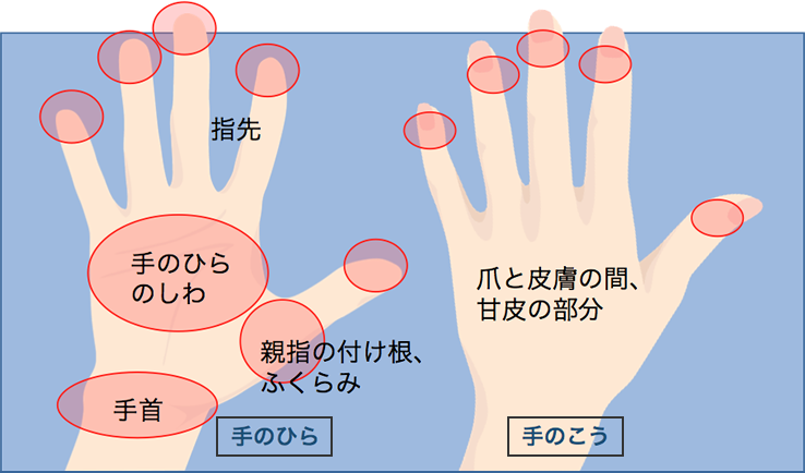 洗い残しの多い部分