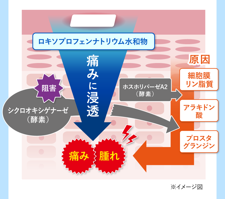 痛みの発生メカニズム 図